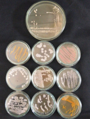 Actinobacteria Isolation from Sacha inchi